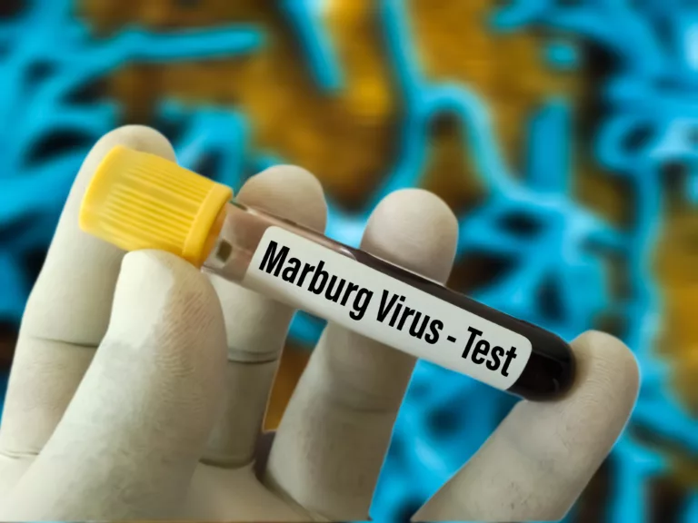 Marburg Virus Test